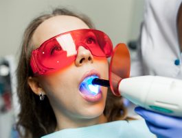 8 Facts About Fluoride Treatment Everyone Should Know